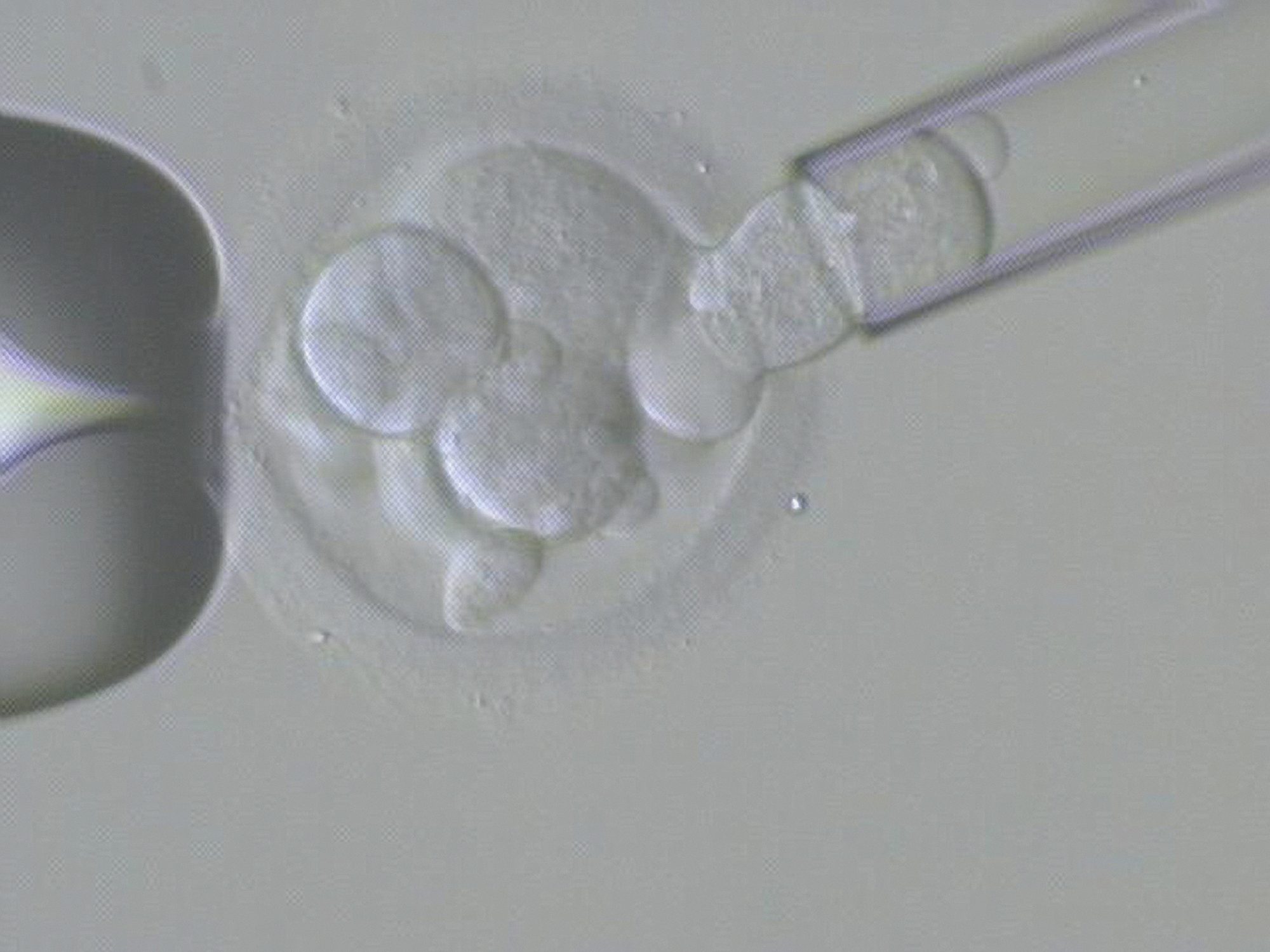Embryo biopsy