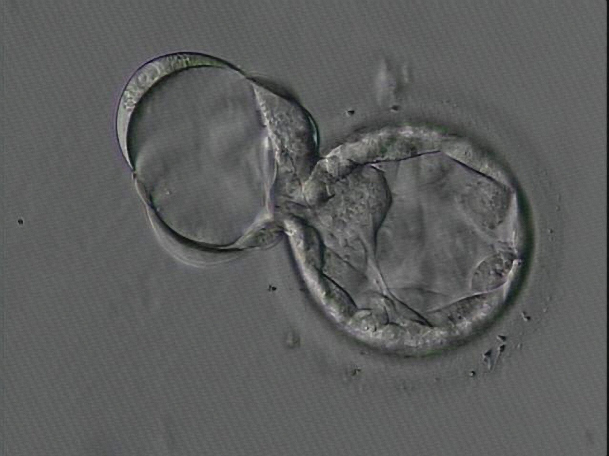 Blastocyst embryo