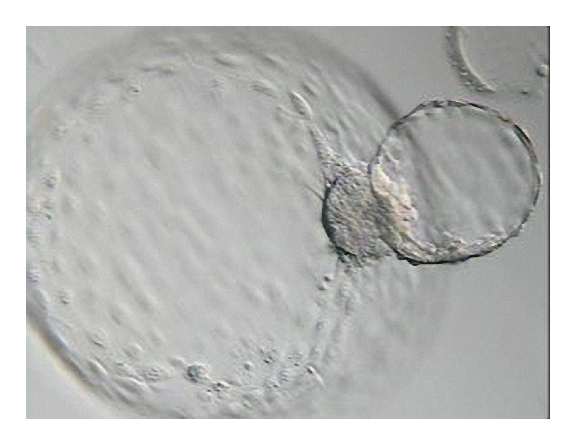 Day seven embryo